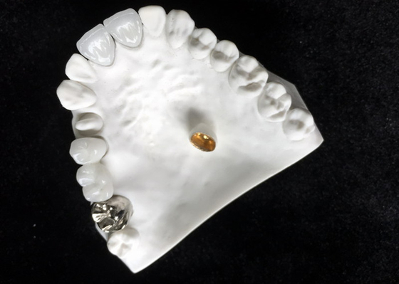 Materiale biologico alta tecnologia della buona di biocompatibilità corona dentaria della porcellana