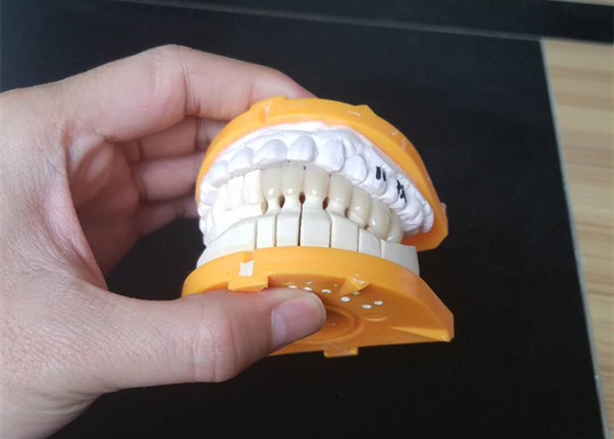 Corone ceramiche su ordinazione di dimensione PFM per i denti posteriori ed anteriori