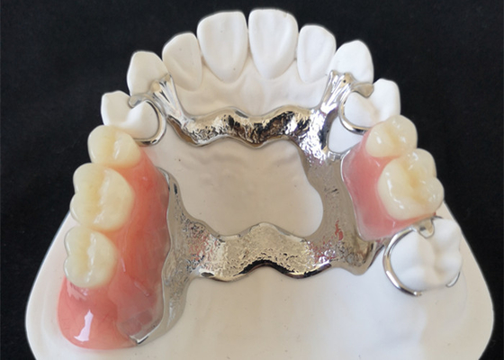 Alta definizione di cad di camma PFM del ponte di superficie liscio su ordinazione della corona