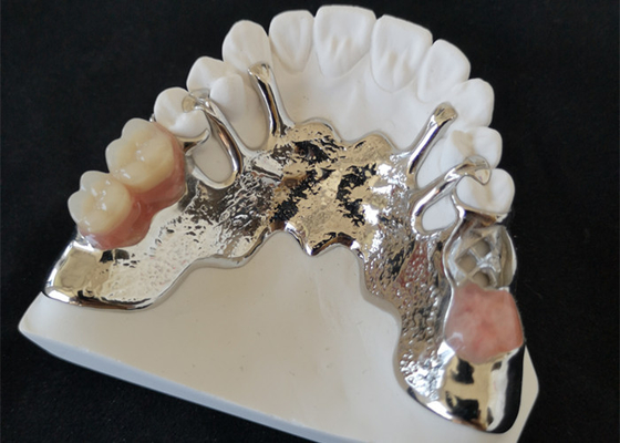Le corone dentarie della stampante PFM dell'OEM 3D gettano un ponte su alto Intermiscibility biologico