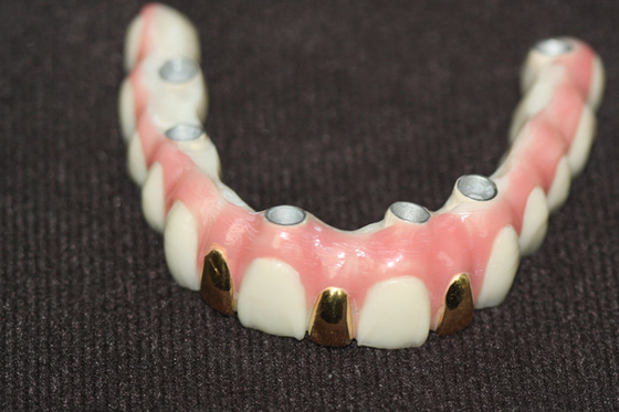 Precisione Digital 3D che stampa il metallo di Antivari dell'impianto dentario basato