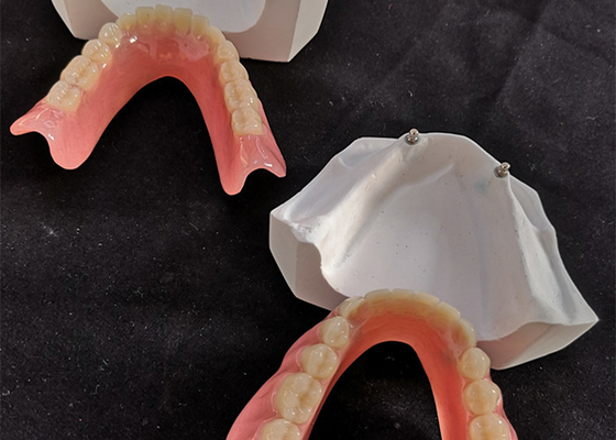 L'impianto dentario comodo Overdenture di camma di cad facile mantiene