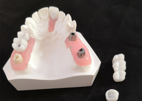 Impianto dentario Antivari di buona inter miscibilità biologica con approvazione di FDA