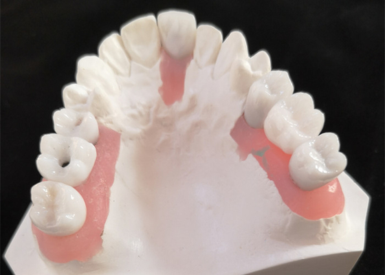 Impianto dentario Antivari di buona inter miscibilità biologica con approvazione di FDA