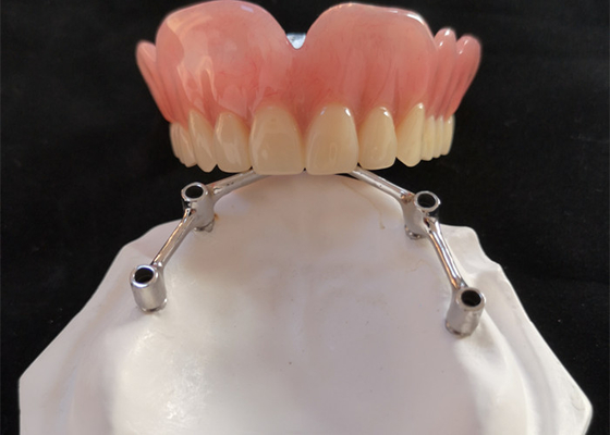 Impianti dentari di FDA della corona dell'impianto del dente di COCR con Antivari di titanio