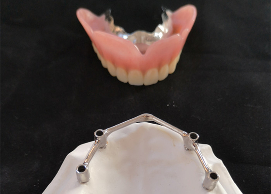 Impianti dentari di FDA della corona dell'impianto del dente di COCR con Antivari di titanio