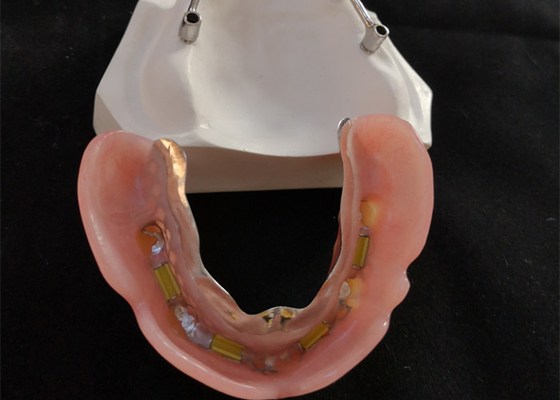 Bar di impianto dentale in titanio/puro titanio per il centro digitale CAD CAM