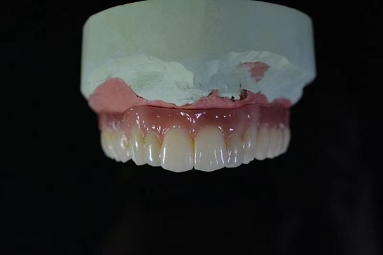 Materiale biologico alta tecnologia di Antivari dell'impianto dentario di camma di sicurezza cad di salute