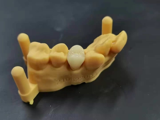 OEM 3D che stampa progettazione dentaria di Digital del laboratorio della protesi dentaria acrilica flessibile