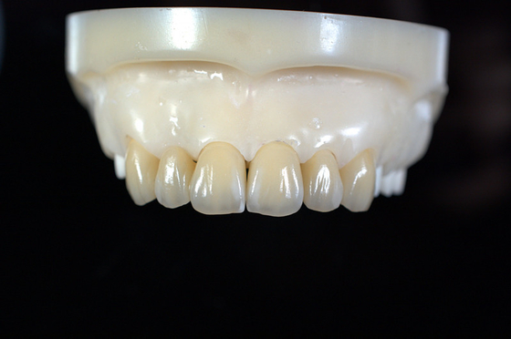 Laboratorio dentistico di protesi circoniali personalizzate - consegna e riparazione veloci