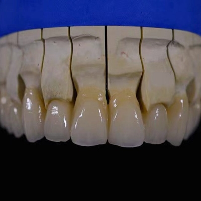 Ristrutturazione di ponti in zirconio in bianco in zirconio Materiale di porcellana: Vita VM9 in polvere di porcellana