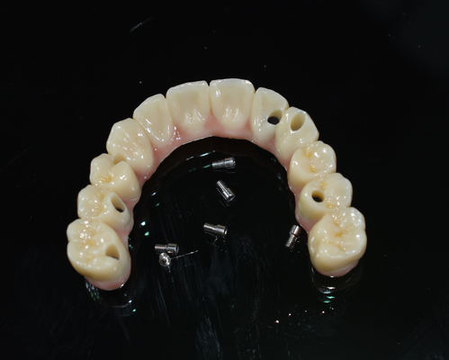 Corona dentale in zirconia: denti di aspetto naturale, durevoli e sicuri