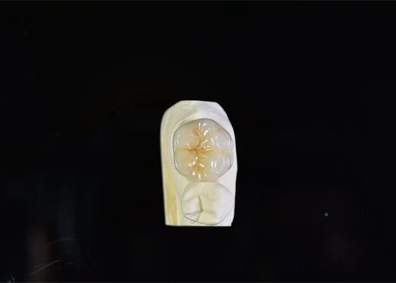 Corone dentale di porcellana di super resistenza ad alta intermiscibilità biologica