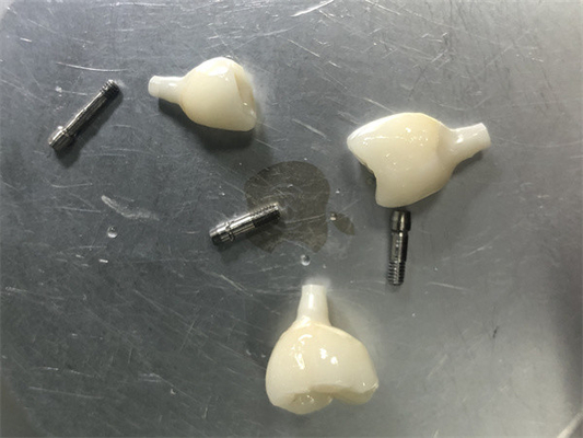 Restauro dell' impianto di zirconia Nessun problema di colore