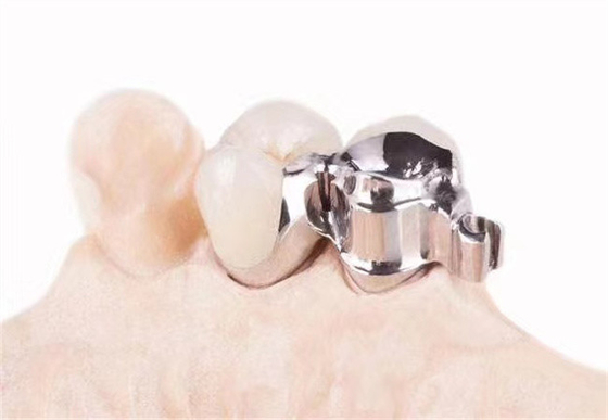 Accessori di precisione personalizzati per cliniche dentistiche