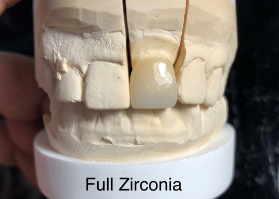 3D multi-livello di contorno completo Zirconia Risolvere il problema della mancanza di trasparenza