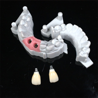 Precise CAD/CAM Design Zirconia Corona dentale per l'adattamento