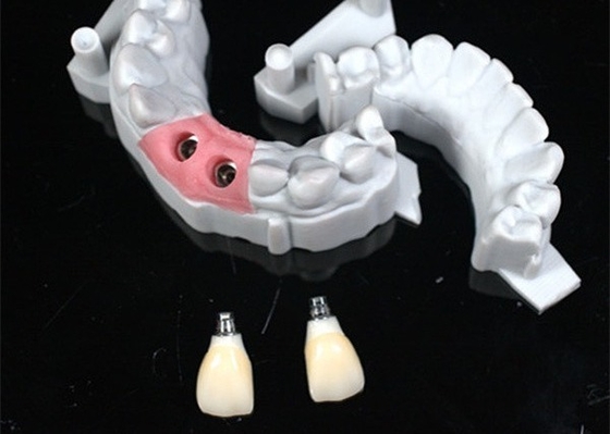 Precise CAD/CAM Design Zirconia Corona dentale per l'adattamento