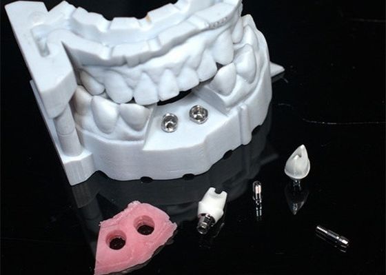 Modello 3D Corona di zirconia