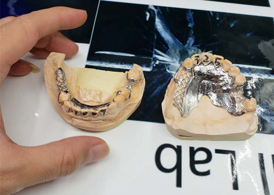 L'alta precisione CAD-CAM ha riparato la progettazione smontabile della digitalizzazione del ponte