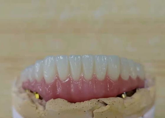 FDA Corona di zirconio con protesi dentarie a supporto di impianto per laboratorio dentale