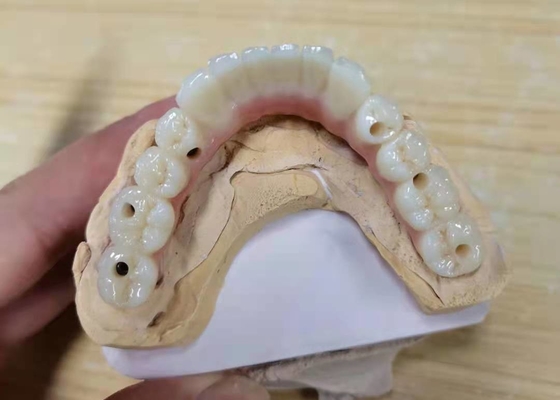 FDA Corona di zirconio con protesi dentarie a supporto di impianto per laboratorio dentale