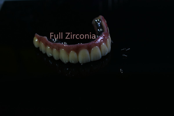 Materiale biologico alta tecnologia di Antivari dell'impianto dentario di camma di sicurezza cad di salute