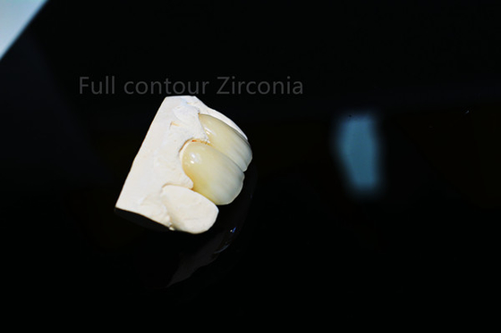 Forma su ordinazione sottile della corona ceramica piena durevole di biossido di zirconio bella