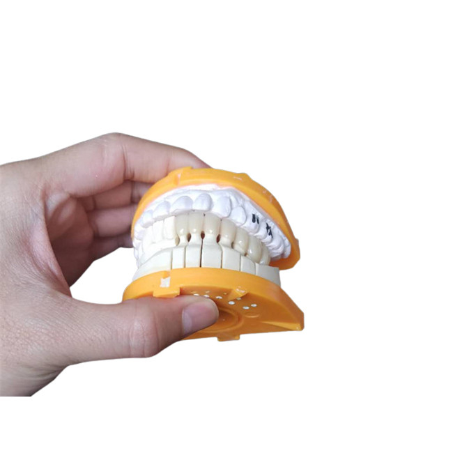 Corone ceramiche su ordinazione di dimensione PFM per i denti posteriori ed anteriori