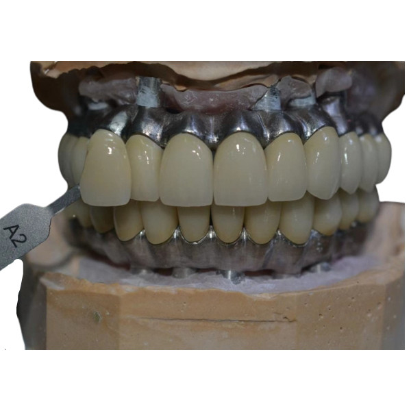Materiale biologico della corona del metallo di sostegno impianto resistente alla corrosione del Cr di Co