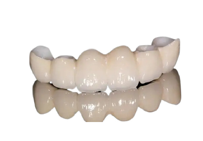Aspetto naturale della corona dentaria resistente alla corrosione della porcellana per Front Teeth/denti posteriori