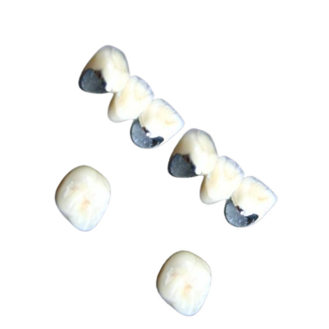 Denti dentari della porcellana di Chrome del cobalto della corona della porcellana non allergica resistenti alla corrosione