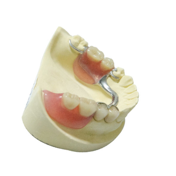 Prodotti dentari del laboratorio delle protesi dentarie di ripristino parziale smontabile d'acciaio della protesi dentaria