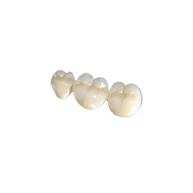 Stabilità della corona di igiene orale buona del ponte del cambiamento di colore dentario del dente