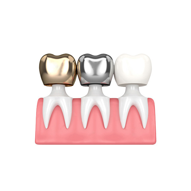 Stalla non facile da indossare dentaria di colore delle corone e dei ponti di buona biocompatibilità
